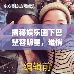 揭秘娛樂圈下巴整容明星，誰悄悄整過下巴？