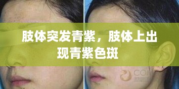 肢體突發(fā)青紫，肢體上出現(xiàn)青紫色斑 