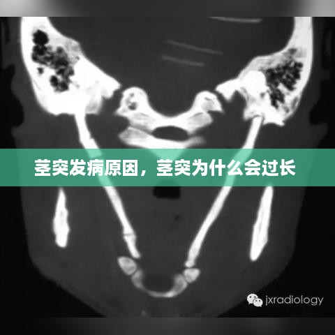 莖突發(fā)病原因，莖突為什么會(huì)過長 