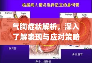 氣胸癥狀解析，深入了解表現(xiàn)與應(yīng)對(duì)策略