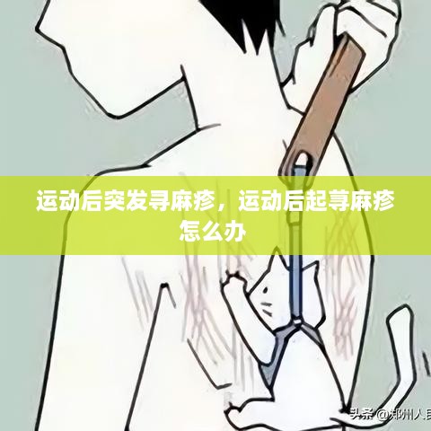 運(yùn)動(dòng)后突發(fā)尋麻疹，運(yùn)動(dòng)后起蕁麻疹怎么辦 
