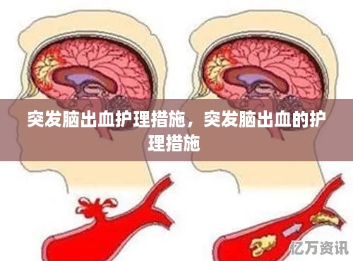 突發(fā)腦出血護(hù)理措施，突發(fā)腦出血的護(hù)理措施 