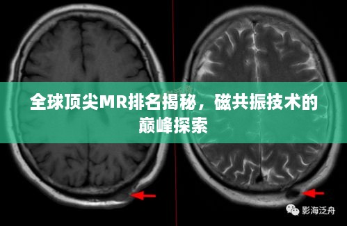 全球頂尖MR排名揭秘，磁共振技術(shù)的巔峰探索