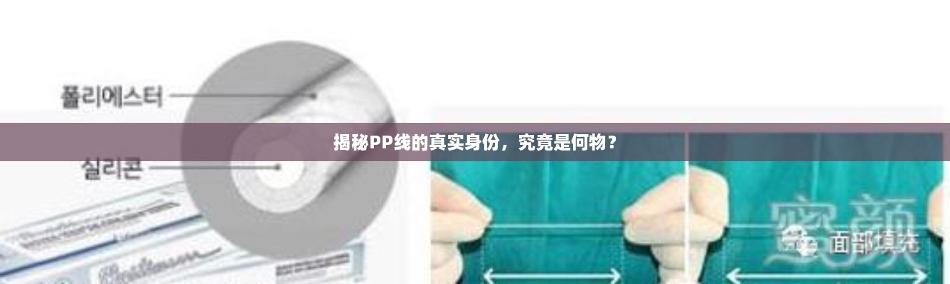 揭秘PP線的真實身份，究竟是何物？