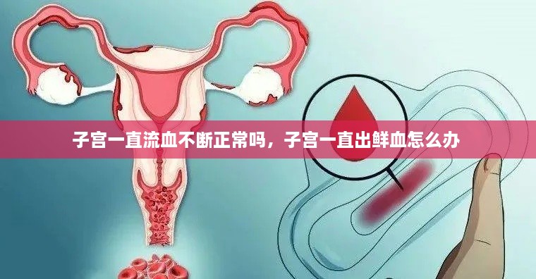 子宮一直流血不斷正常嗎，子宮一直出鮮血怎么辦 