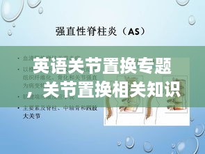 英語關(guān)節(jié)置換專題，關(guān)節(jié)置換相關(guān)知識(shí) 