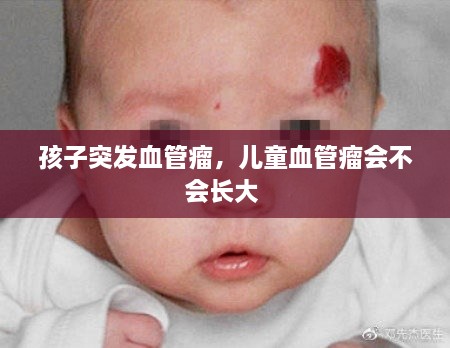 孩子突發(fā)血管瘤，兒童血管瘤會不會長大 