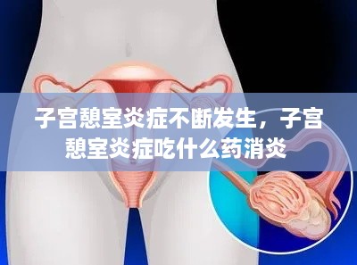 子宮憩室炎癥不斷發(fā)生，子宮憩室炎癥吃什么藥消炎 