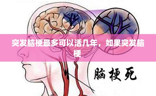突發(fā)腦梗最多可以活幾年，如果突發(fā)腦梗 