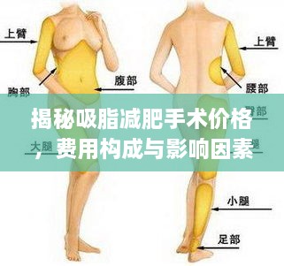 揭秘吸脂減肥手術(shù)價格，費用構(gòu)成與影響因素全解析